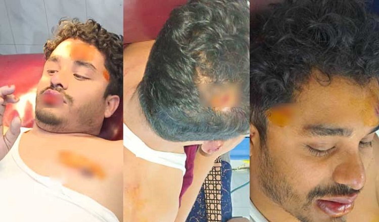 হামলায় আহত ২২ সাংবাদিক
